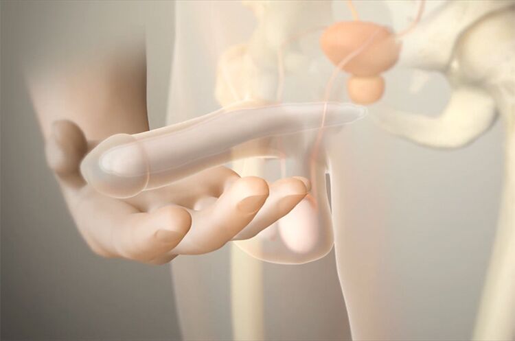 Gelimplantate, um ein Mitglied zu erhöhen