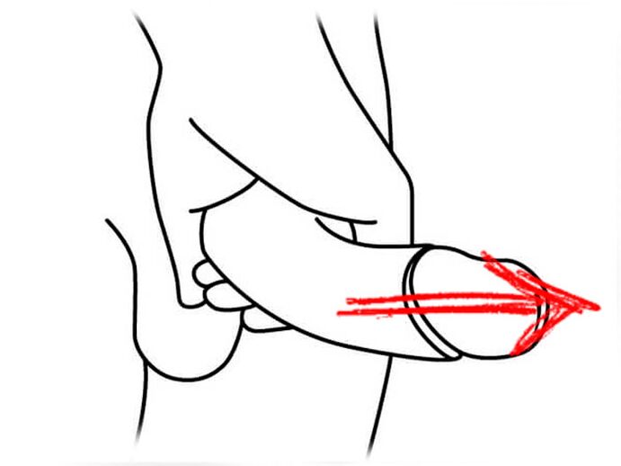 Dehnen Sie den Penis, um ihn zu vergrößern